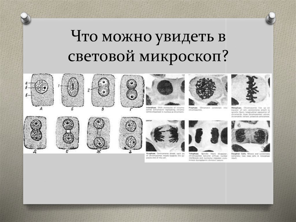 Что в световой микроскоп можно увидеть?